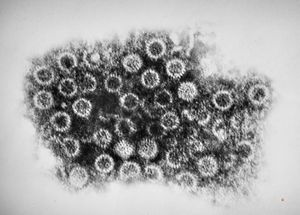 rotavirus isolated from intestine rotavirus isolated from intestine